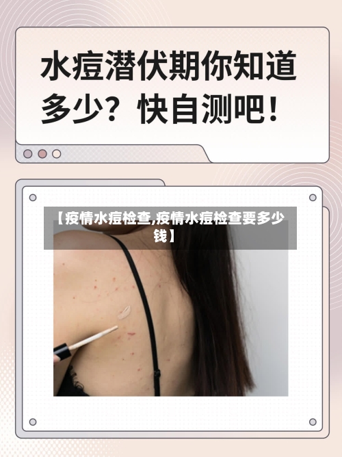 【疫情水痘检查,疫情水痘检查要多少钱】-第3张图片