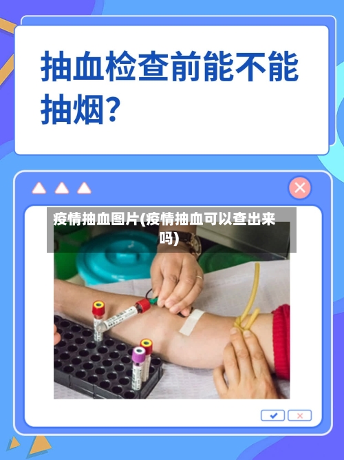 疫情抽血图片(疫情抽血可以查出来吗)-第2张图片